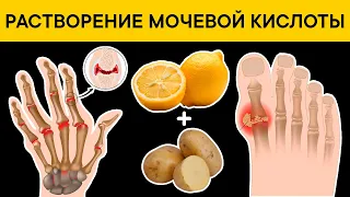 Как моментально растворить КРИСТАЛЛЫ МОЧЕВОЙ КИСЛОТЫ и остановить ПОДАГРУ? 9 продуктов от подагры