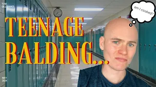 How to stop TEENAGE BALDING in 2 steps!