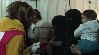 Barely alive after IS, Syrian babies haunted by malnutrition