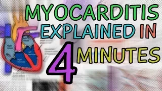 WHAT IS MYOCARDITIS? MYOCARDITIS EXPLAINED IN 4 MINUTES - CAUSES, SYMPTOMS, DIAGNOSIS, TREATMENT