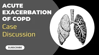 Case Discussion || Acute Exacerbation of COPD