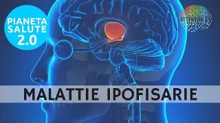 Malattie ipofisarie: Cushing, acromegalia, diabete insipido.