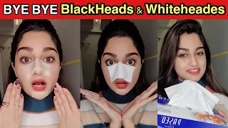 Home-made EGG PEEL OFF MASK for BLACKHEADS & WHITEHEADS & INSTANT SMOOTH NOSE!😍#shorts#youtubeshorts