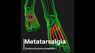 Dolore alla pianta del piede: potrebbe trattarsi di Metatarsalgia