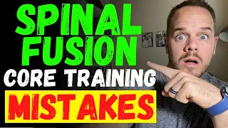 4 Core Training MISTAKES After A Spinal Fusion Surgery - DON'T MAKE THESE MISTAKES
