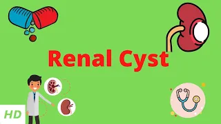 Renal Cyst, Causes, Signs and Symptoms, Diagnosis and Treatment.