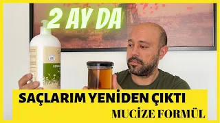 2 AY'da SONUÇ !! Saçlarım Yeniden Çıktı l Saç Çıkaran Mucize Doğal Kür l Saç Dökülmesine Karşı Çözüm