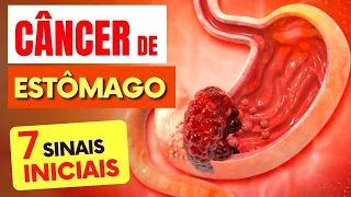 7 SINAIS de Alerta para CÂNCER DE ESTÔMAGO que Todos Deveriam Saber (e Dicas IMPORTANTES)