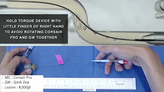 A quick tutorial on advancing your Microcatheter through the lesion.