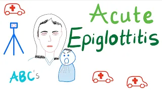 Acute Epiglottitis | Causes, Symptoms, Diagnosis and Management