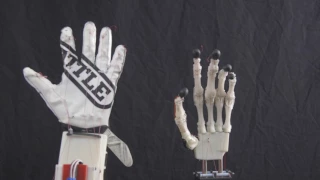 3D printed Biomimetic Robot Prosthetic Hand Project - Final