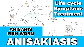 Anisakiasis | Anisakis | Life cycle, symptoms, treatment | By phanindra gupta