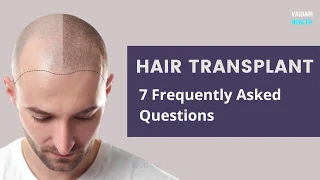 Hair Transplant- 7 Frequently Asked Questions