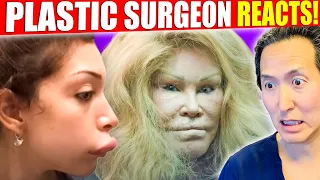 The 15 WORST Celebrity Plastic Surgery DISASTERS!