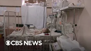 Ukrainian boy cries for his dad from hospital bed after family injured in Mariupol