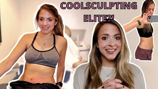 NEW & IMPROVED COOLSCULPTING? Come With Me to Test out Coolsculpting Elite| Full Procedure Overview