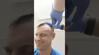 Having staples stitches removed from my head after brain surgery