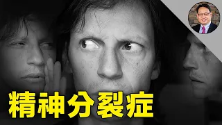 經常被誤解的精神分裂症（思覺障礙)，楊醫師給你一次講清楚。