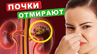 10 Признаков того, что Ваши ПОЧКИ ОТМИРАЮТ! 98% даже НЕ ЗНАЮТ об этом!