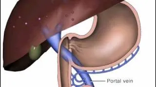 Pharmacology: Oral Meds Absorption