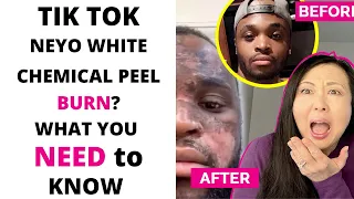 Tik Tok NEYO WHITE CHEMICAL PEEL BURN(?) WHAT YOU NEED TO KNOW GRAPHIC IMAGES