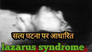 Lazarus Syndrome