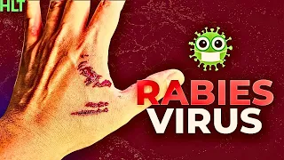 Why Rabies Is The Scariest Disease Ever