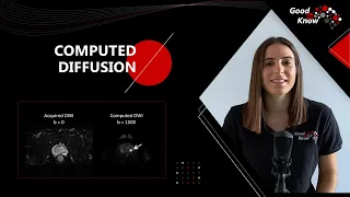 Good to Know - Computed Diffusion (cDWI)