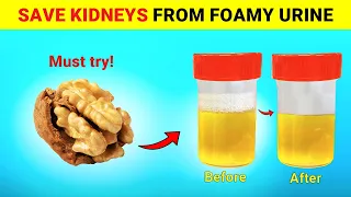 Top 6 Super Foods To Help Stop Proteinuria  and Heal Your Kidneys