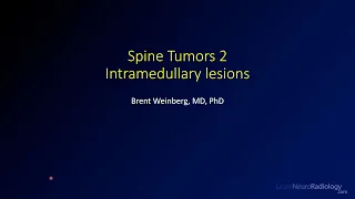 Spine tumors 2 – Intramedullary lesions