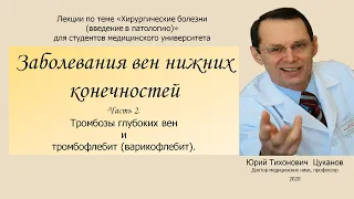 Болезни вен, часть 2  Венозные тромбозы, тромбофлебиты. Лекция для студентов медуниверситета.