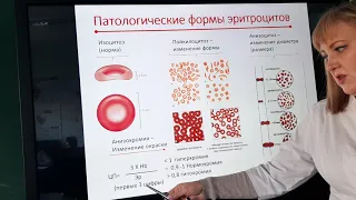 Патология эритрона(2)