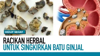 Racikan Herbal Untuk Singkirkan Batu Ginjal | Hidup Sehat