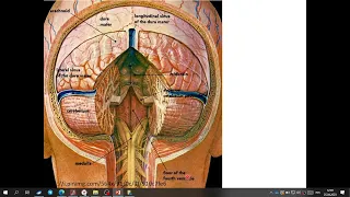 Четвертый желудочек и мозговые паруса. Запись 2023 04 25 12 43 56