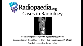 Penetrating renal injury by a glass foreign body (Radiopaedia.org) Cases in Radiology