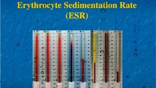 ESR test theory and practical in hindi and urdu