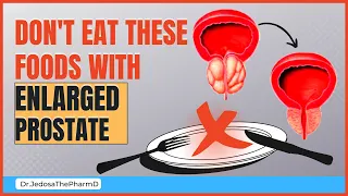 Foods to AVOID with Your Enlarged Prostate