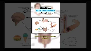 Relação Intestino X Pele na formação da acne #shorts