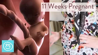 11 Weeks Pregnant: What You Need To Know - Channel Mum