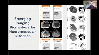 MRI Methods of Neuroimaging Research to improve diagnosis and understand disease progression