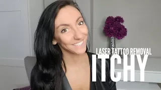 Laser Tattoo Removal Itchy