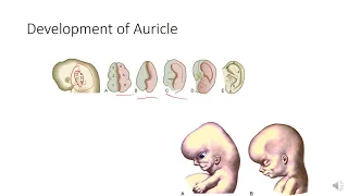 Development of Middle and External Ear