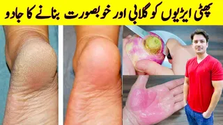 Cracked Heels Treatment At Home By ijaz Ansari | Cracked Heels Homemade Remedy |