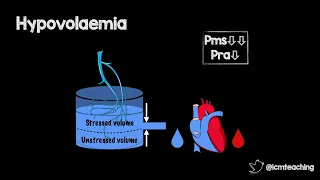 Fluids or vasopressors?