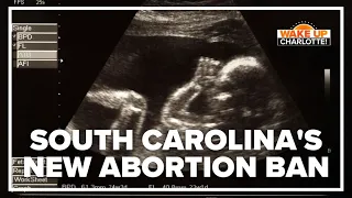 South Carolina Senate passes new abortion ban bill