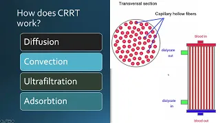 CRRT & MARS