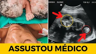 ÚLTIMAS NOTÍCIAS Mulher Da A Luz a GEMÊOS Mais Médico Fica ASSUSTADO Ao Notar Algo