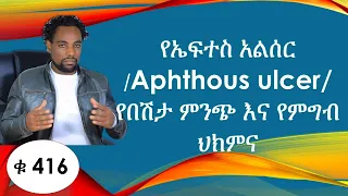 የኤፍተስ አልሰር /Aphthous ulcer/  የበሽታ ምንጭ እና የምግብ ህክምና