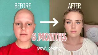 6 Months Post Chemo HAIR GROWTH!