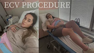 My ECV procedure... | Justinaksy